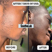 SootheLab Aftershave