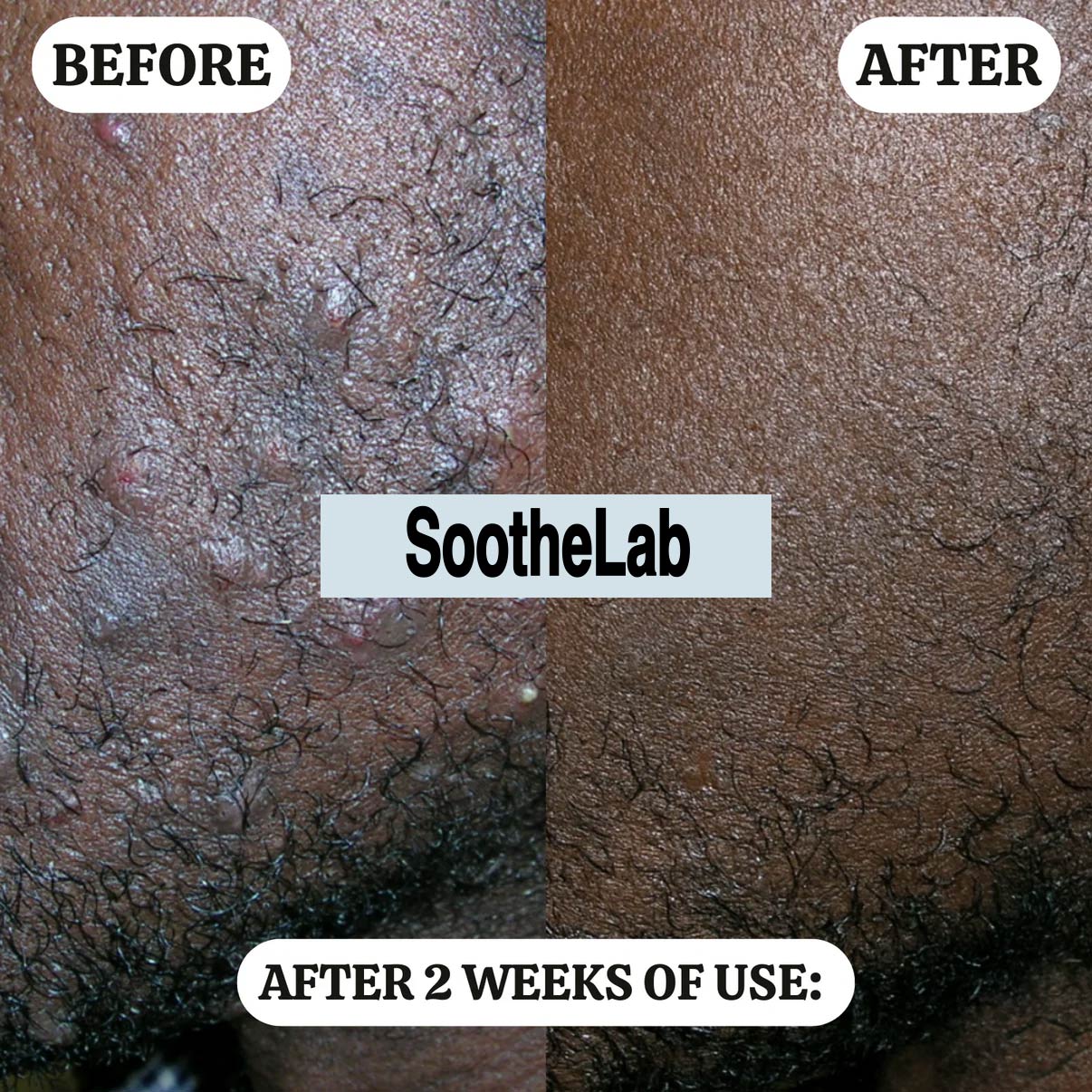 SootheLab Aftershave