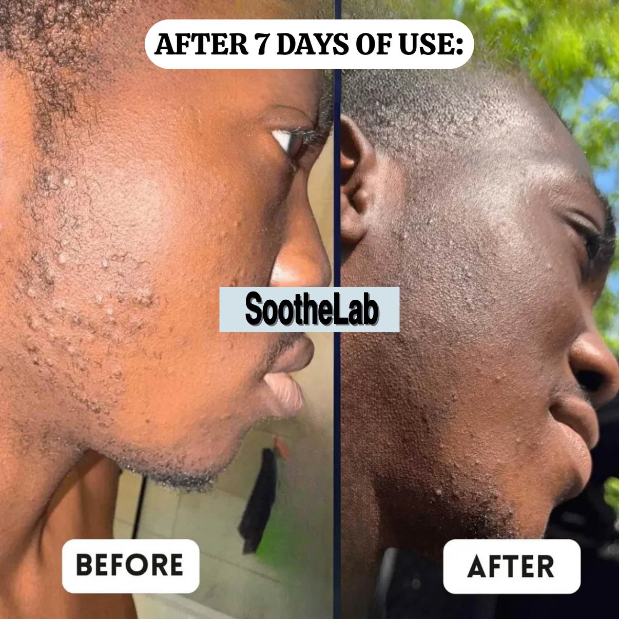 SootheLab Aftershave